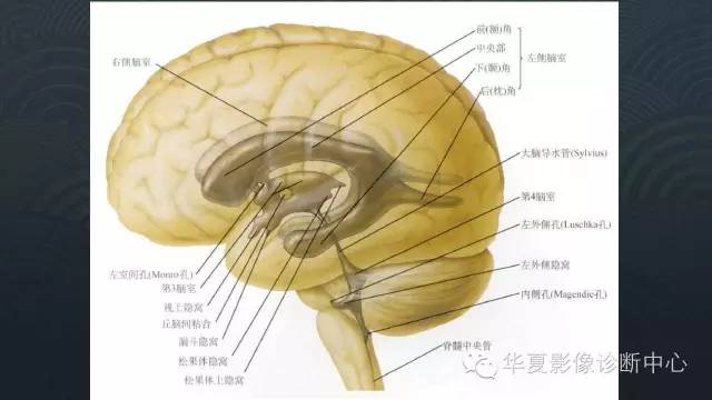【PPT】脑室常见实质性占位病变的诊断