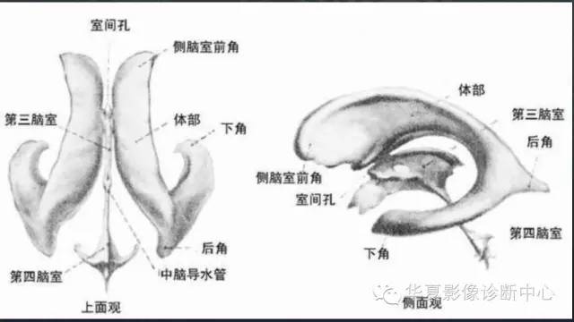 【PPT】脑室常见实质性占位病变的诊断