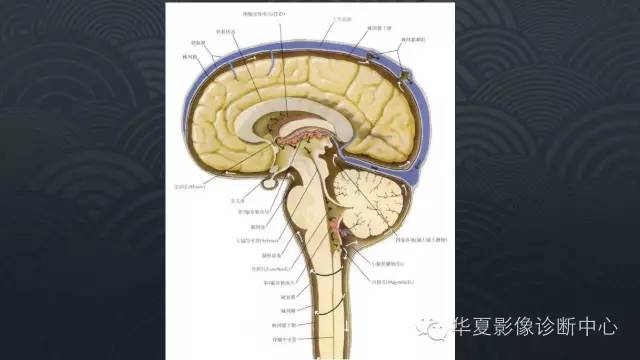 【PPT】脑室常见实质性占位病变的诊断