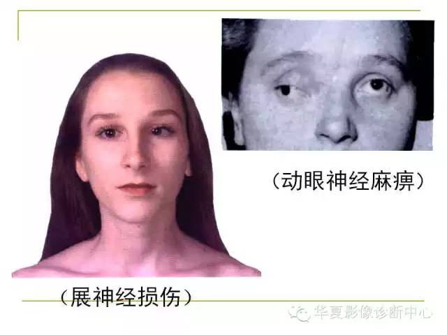 【PPT】脑神经