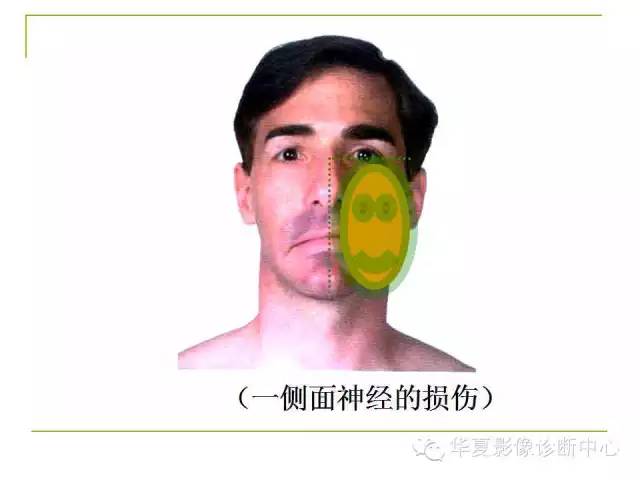 【PPT】脑神经