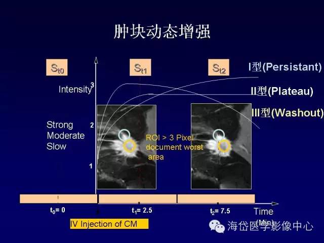【PPT】乳腺MRI诊断解析 【PPT】乳腺MRI诊断解析