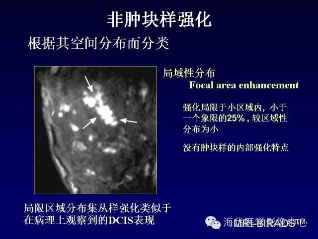 【PPT】乳腺MRI诊断解析 【PPT】乳腺MRI诊断解析