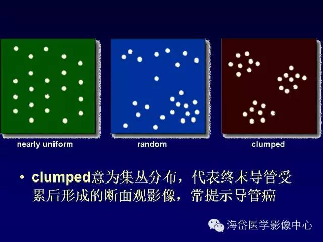 【PPT】乳腺MRI诊断解析 【PPT】乳腺MRI诊断解析