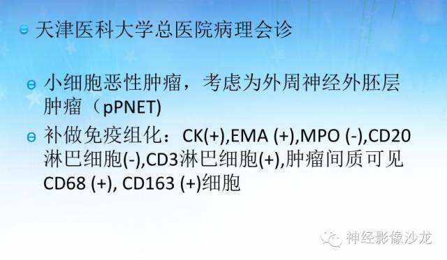 【PPT】外周原始神经外胚层肿瘤1例MR影像表现