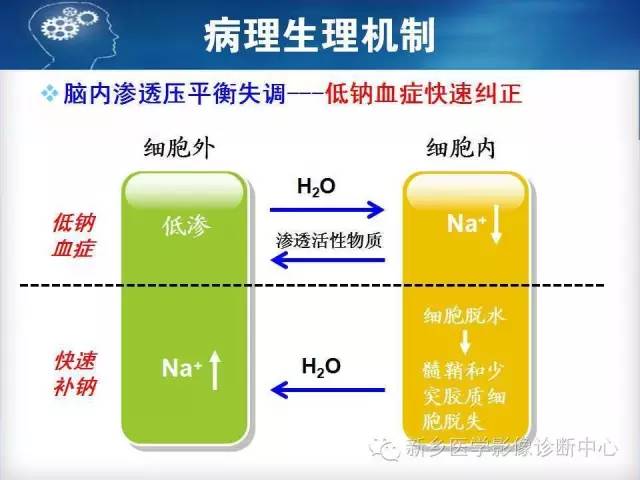 【病例】脑桥中央髓鞘溶解症1例MR影像表现