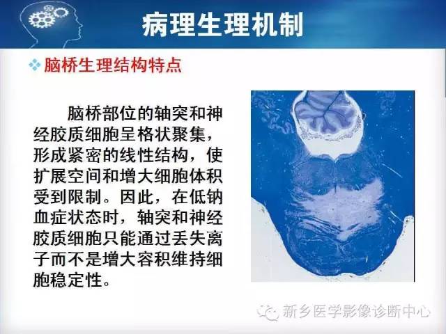 【病例】脑桥中央髓鞘溶解症1例MR影像表现