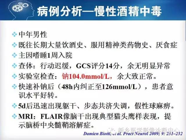 【病例】脑桥中央髓鞘溶解症1例MR影像表现