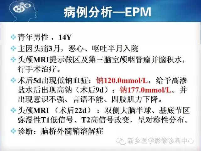 【病例】脑桥中央髓鞘溶解症1例MR影像表现