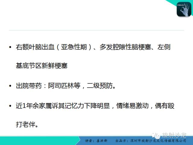 【PPT】脑小血管病MRI影像学研究