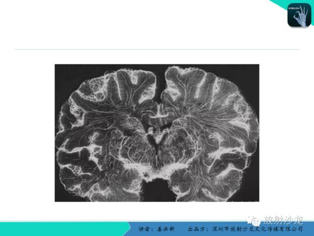 【PPT】脑小血管病MRI影像学研究