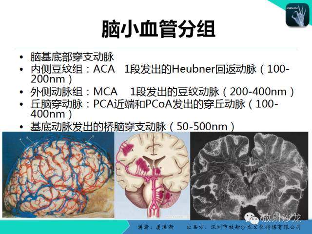 【PPT】脑小血管病MRI影像学研究