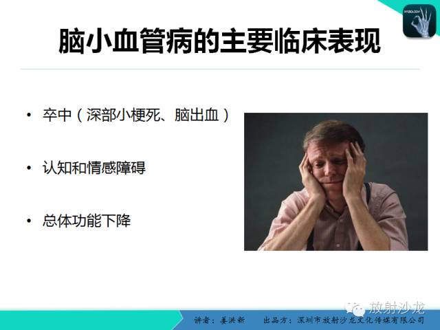 【PPT】脑小血管病MRI影像学研究