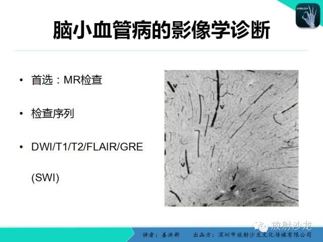 【PPT】脑小血管病MRI影像学研究