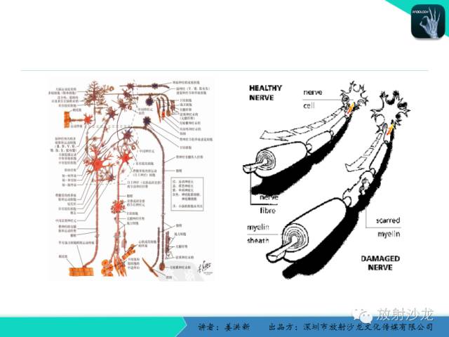 【PPT】脑小血管病MRI影像学研究