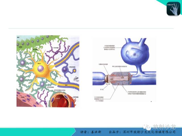 【PPT】脑小血管病MRI影像学研究