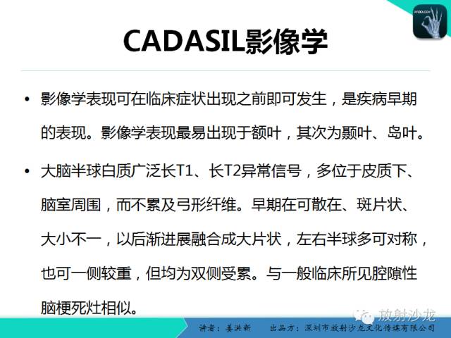 【PPT】脑小血管病MRI影像学研究