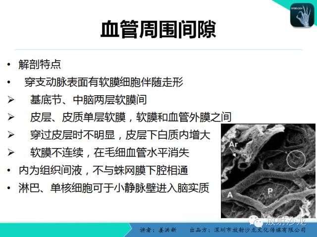 【PPT】脑小血管病MRI影像学研究