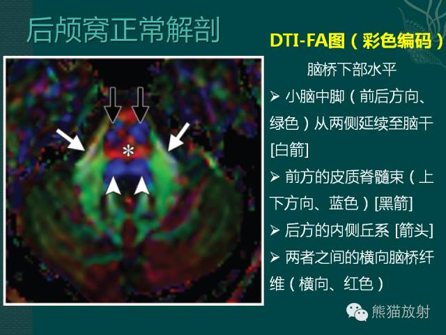 【专题】后颅窝先天性畸形