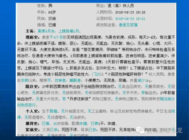 【病例】胃肠道间质瘤伴肝脏转移1例 【病例】胃肠道间质瘤伴肝脏转移1例
