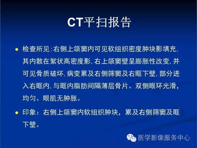 【病例】右侧上颌窦粘液瘤1例CT及MR影像表现