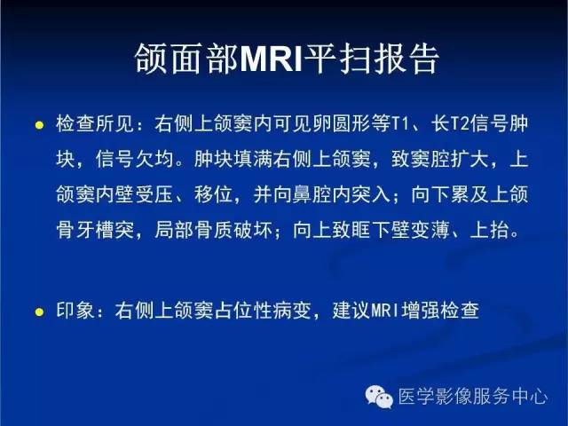 【病例】右侧上颌窦粘液瘤1例CT及MR影像表现