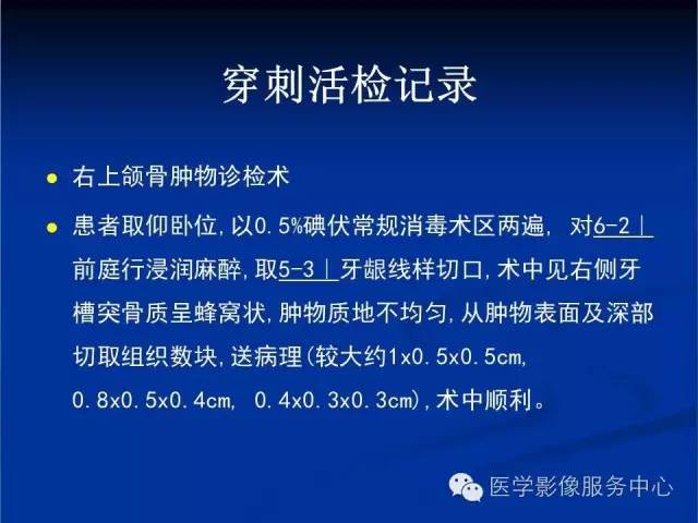 【病例】右侧上颌窦粘液瘤1例CT及MR影像表现