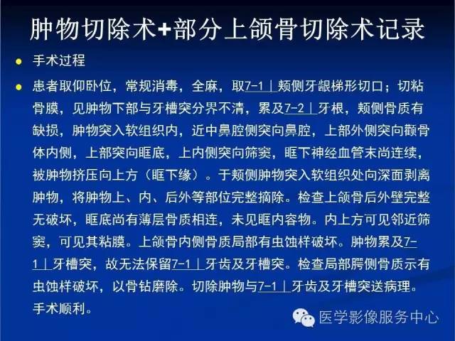 【病例】右侧上颌窦粘液瘤1例CT及MR影像表现