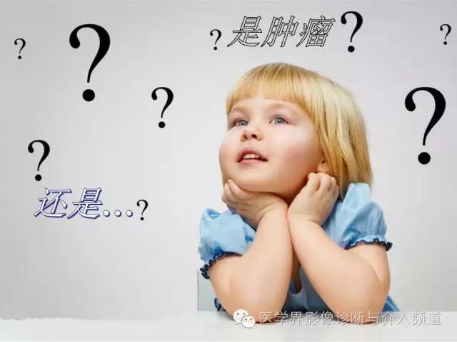 【病例】你以为这是肿瘤，其实这是鱼刺引发的“血案”！