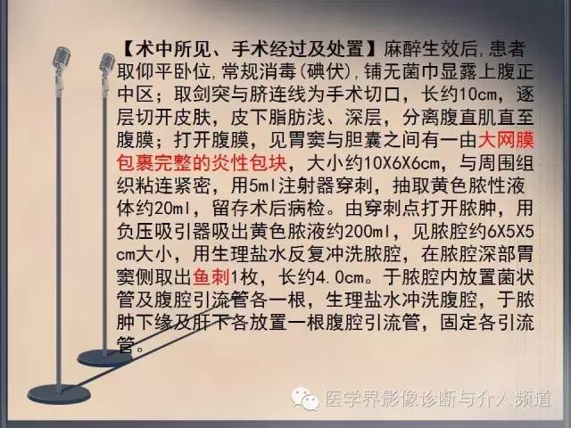 【病例】你以为这是肿瘤，其实这是鱼刺引发的“血案”！