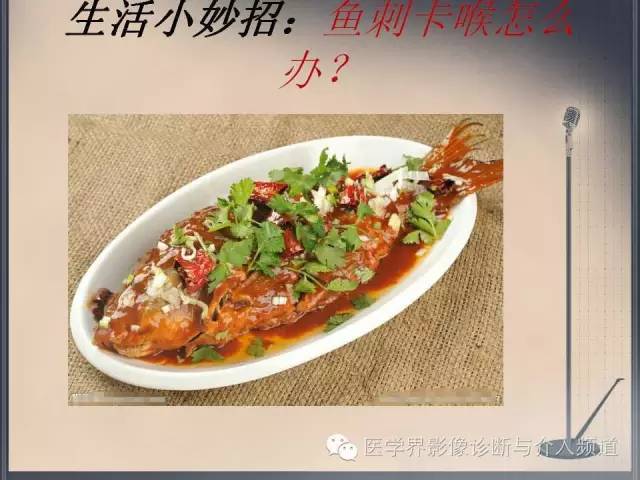 【病例】你以为这是肿瘤，其实这是鱼刺引发的“血案”！