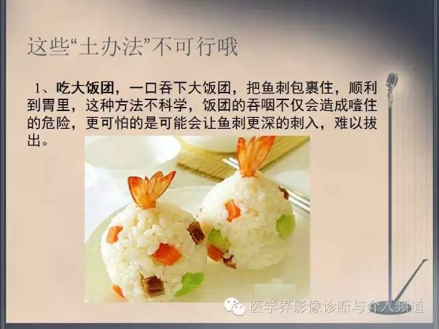 【病例】你以为这是肿瘤，其实这是鱼刺引发的“血案”！