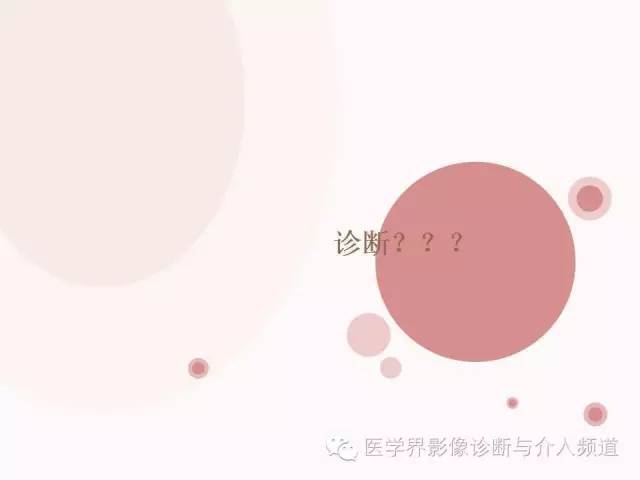 【病例】软骨母细胞瘤2例影像表现与鉴别
