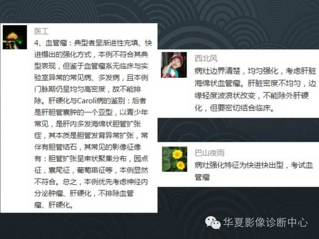【病例】肝硬化伴海绵状血管瘤1例CT影像表现