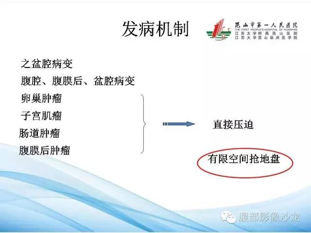 【PPT】盆腔淤血综合征CTA表现 【PPT】盆腔淤血综合征CTA表现
