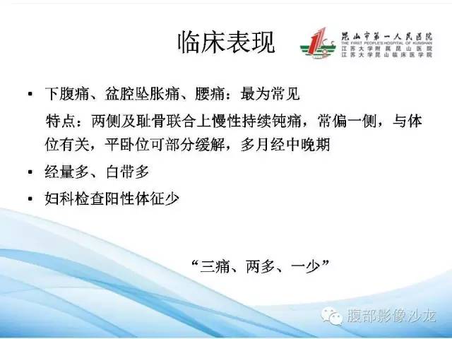 【PPT】盆腔淤血综合征CTA表现 【PPT】盆腔淤血综合征CTA表现