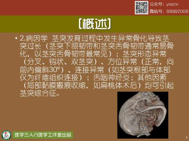 【PPT】茎突综合征