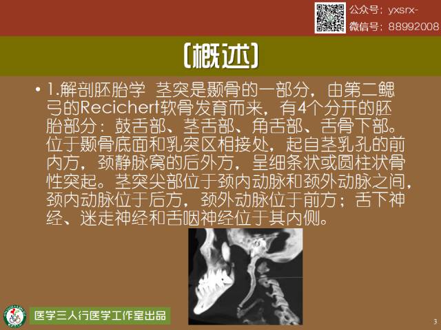 【PPT】茎突综合征