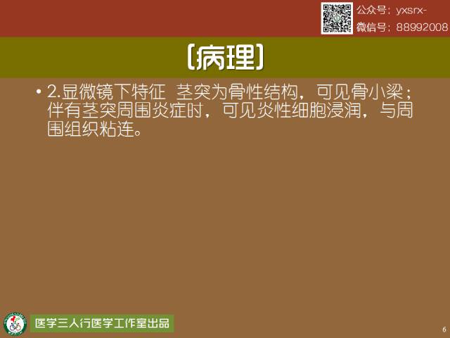 【PPT】茎突综合征