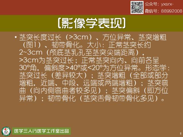 【PPT】茎突综合征