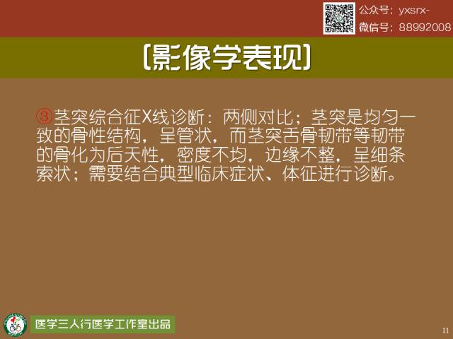 【PPT】茎突综合征