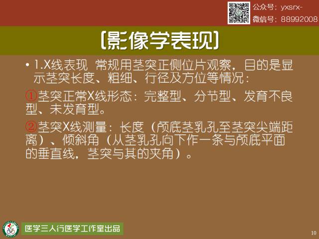 【PPT】茎突综合征