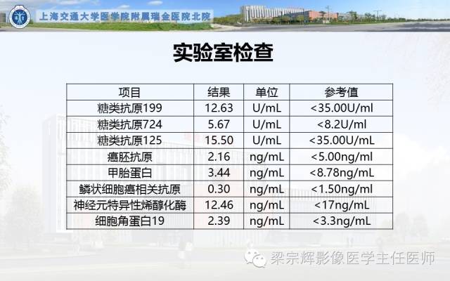 【病例】气管内乳头状瘤1例CT影像表现