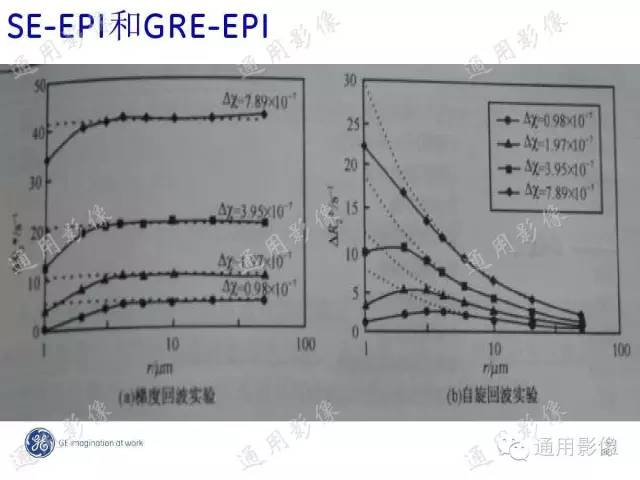 【PPT】PWI原理及临床应用