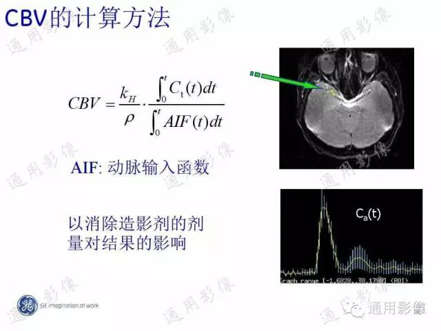 【PPT】PWI原理及临床应用