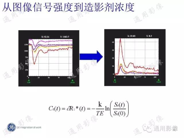 【PPT】PWI原理及临床应用