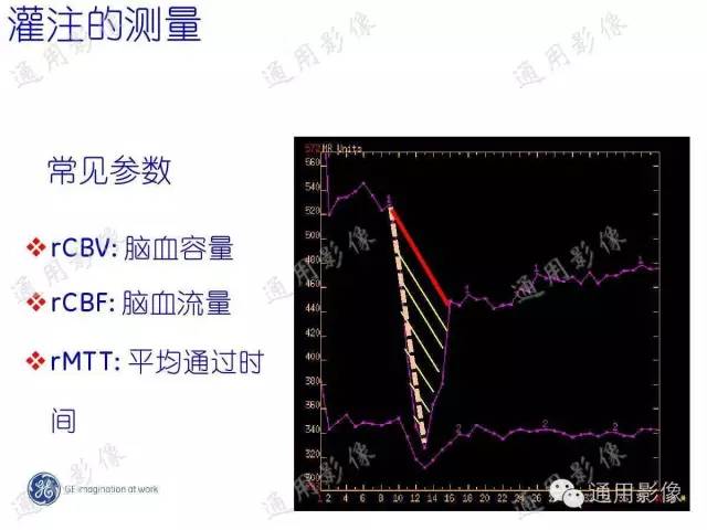 【PPT】PWI原理及临床应用
