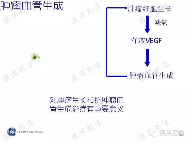 【PPT】PWI原理及临床应用