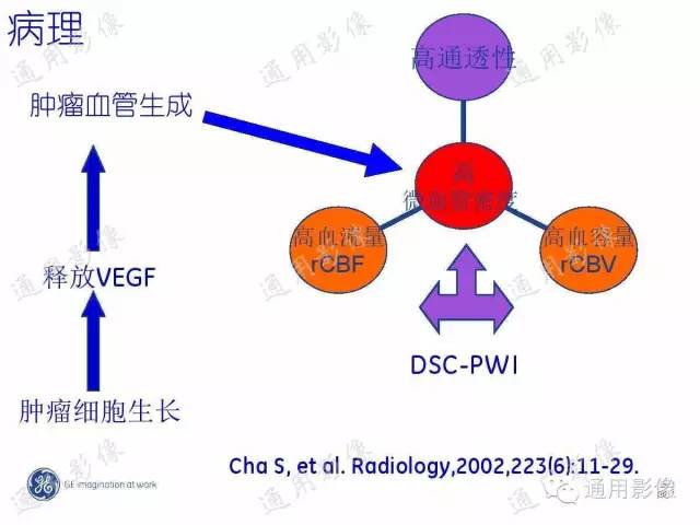 【PPT】PWI原理及临床应用