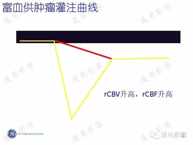 【PPT】PWI原理及临床应用